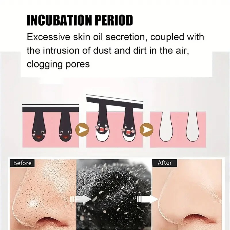 남녀 공용 블랙헤드 제거 마스크, 여드름 완화 및 모공 - Skincare Viral Tiktok 리뷰 및 가격