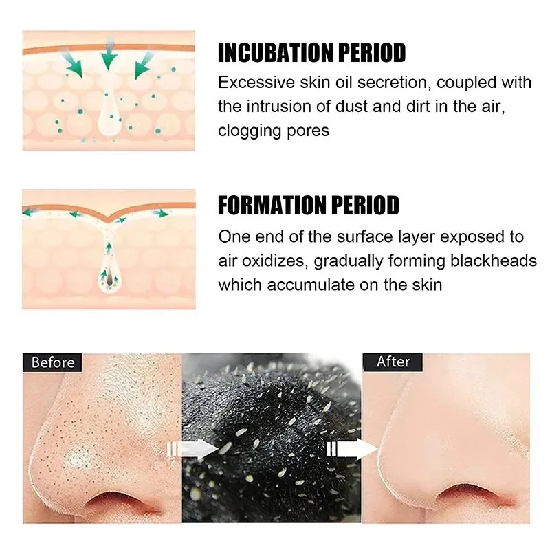 10/150PCS 블랙헤드 제거 마스크 코 스트립 수축 - Skincare Viral Tiktok 리뷰 및 가격